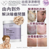 ANP Accumax 袪痘淨滑療程 3盒優惠