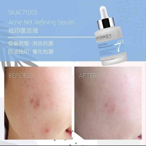 Skinkey 703 祛印復活液 30ml