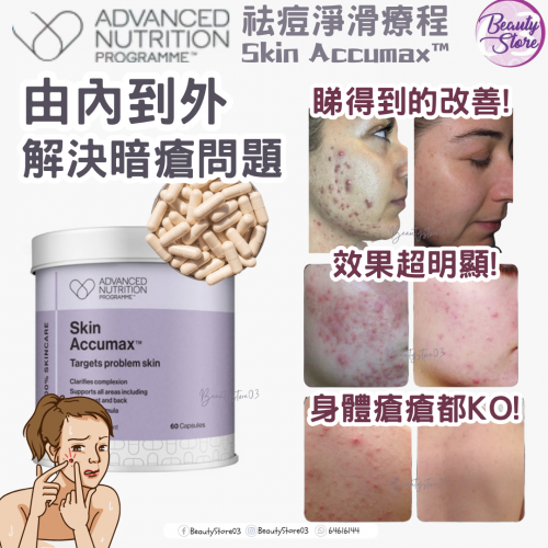 ANP Skin Accumax 袪痘淨滑療程 60粒 ANP Skin Accumax 袪痘淨滑療程 60粒