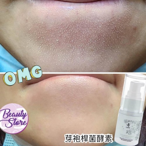 Lafis Peel Essence 酵母煥膚精華 30ml Lafis Peel Essence 酵母煥膚精華 30ml