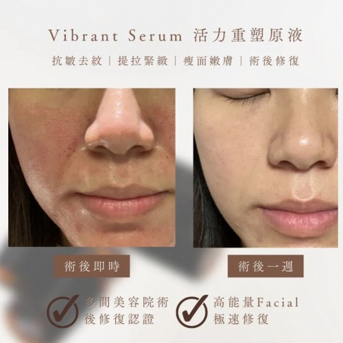 Belle Coeur Vibrant Serum 活力重塑原液10ml Belle Coeur Vibrant Serum 活力重塑原液10ml